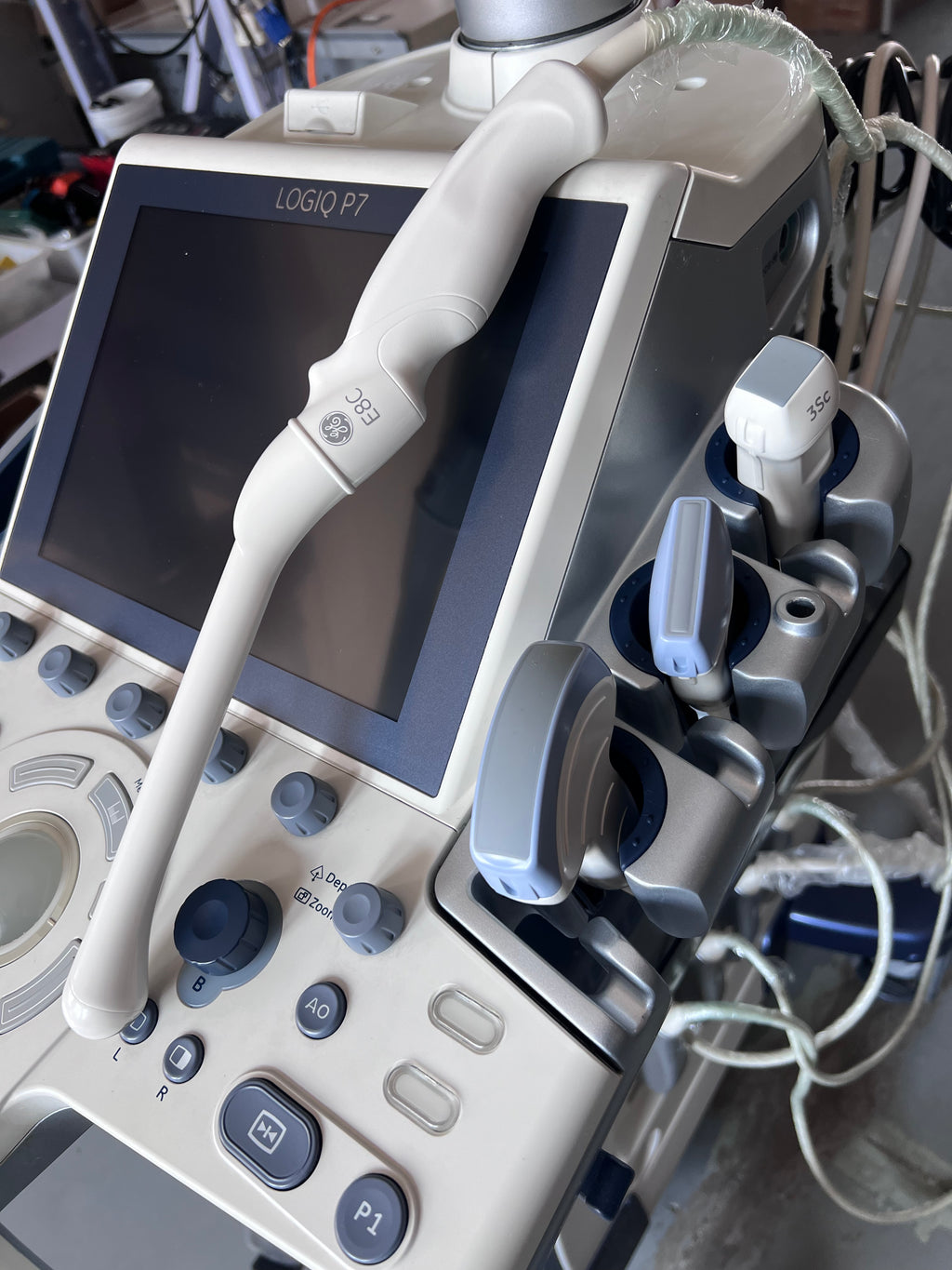 Ultrasound Diagnostic System